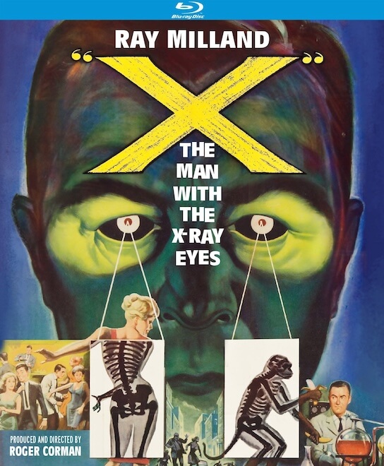 x-ray-eyes-1963